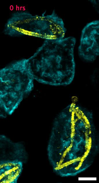 Confocal microscopy of a macrophage engaging a fungal hypha
