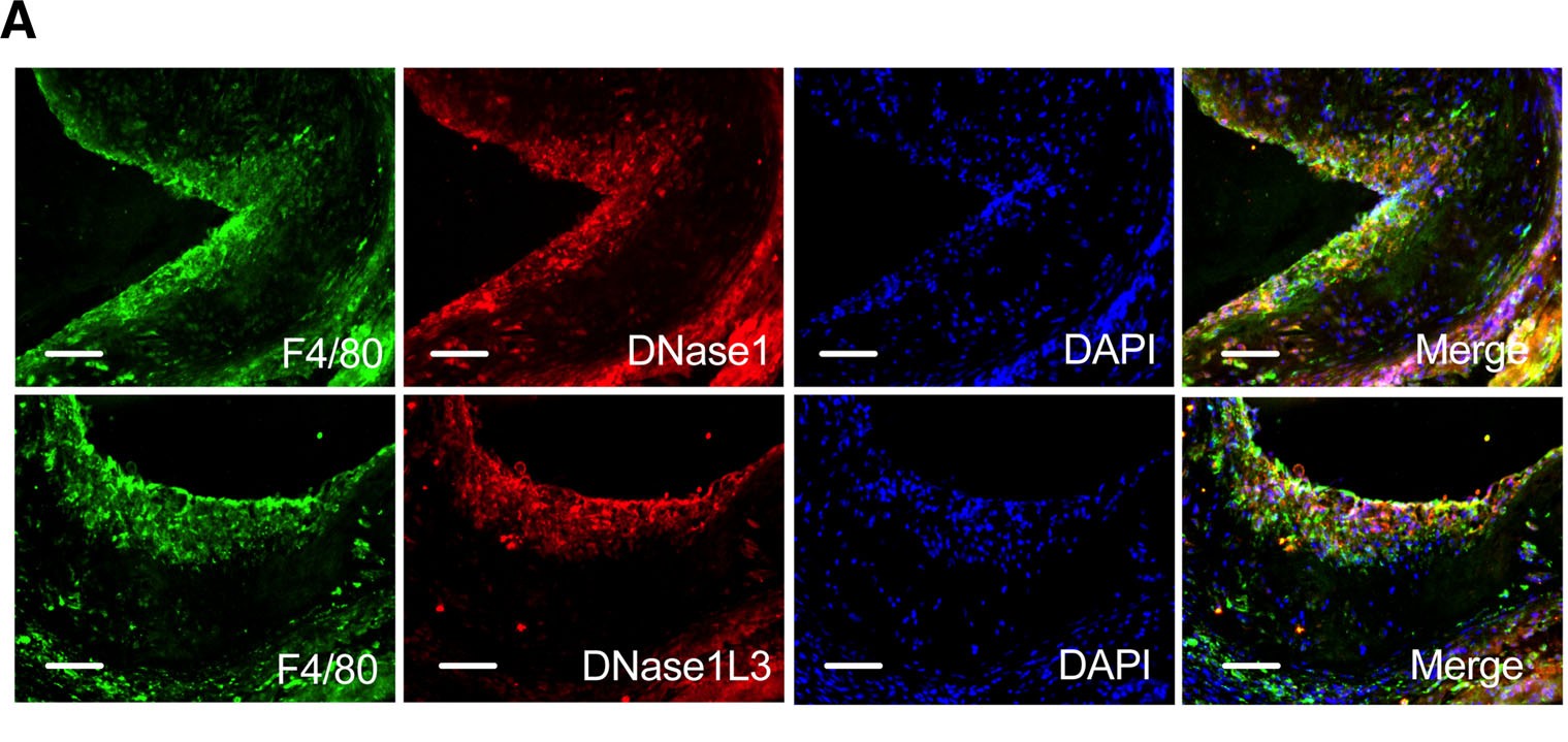 Immunofluorescence of an atherosclerotic plaque: macrophages (F4/80, green), DNase1/DNase1L3 (red), and DAPI nuclei (blue)