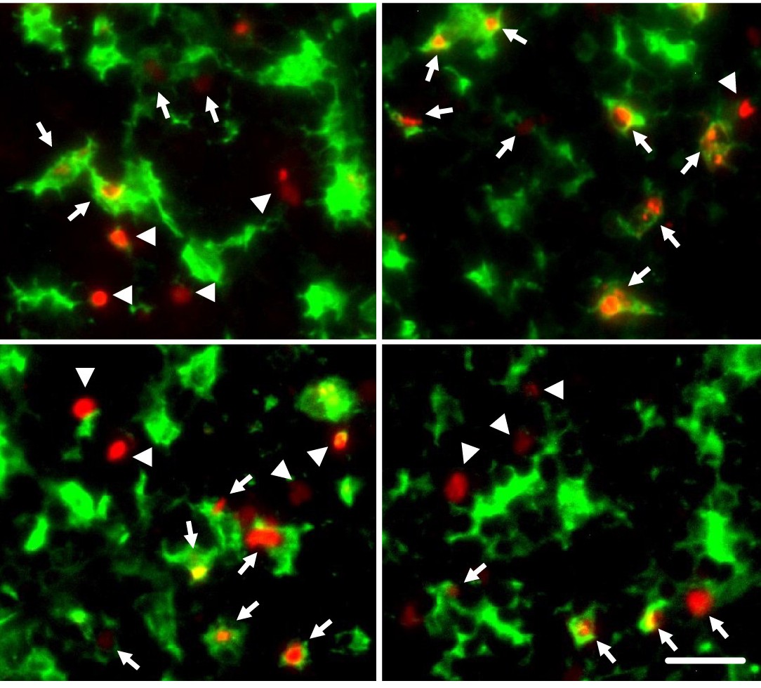 Fluorescence microscopy of macrophage efferocytosis and extracellular-vesicle release