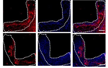 Immunofluorescence of atherosclerotic plaque (F4/80 macrophages in red, DAPI nuclei in blue) from the study