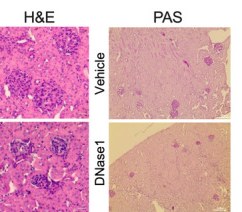 Kidney histology (H&E and PAS staining) showing lupus-like glomerular pathology from the study