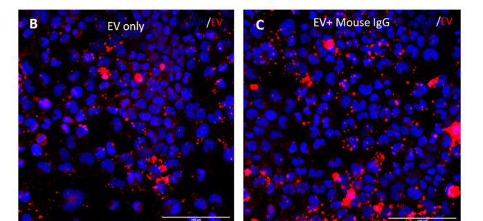 Confocal microscopy of chondrocytes taking up CFSE-labelled extracellular vesicles (EV in red, DAPI nuclei in blue) from the study